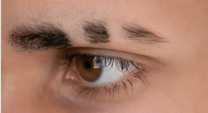 There has been an increase in eyebrow slits throughout the world over the past few years as a trend.