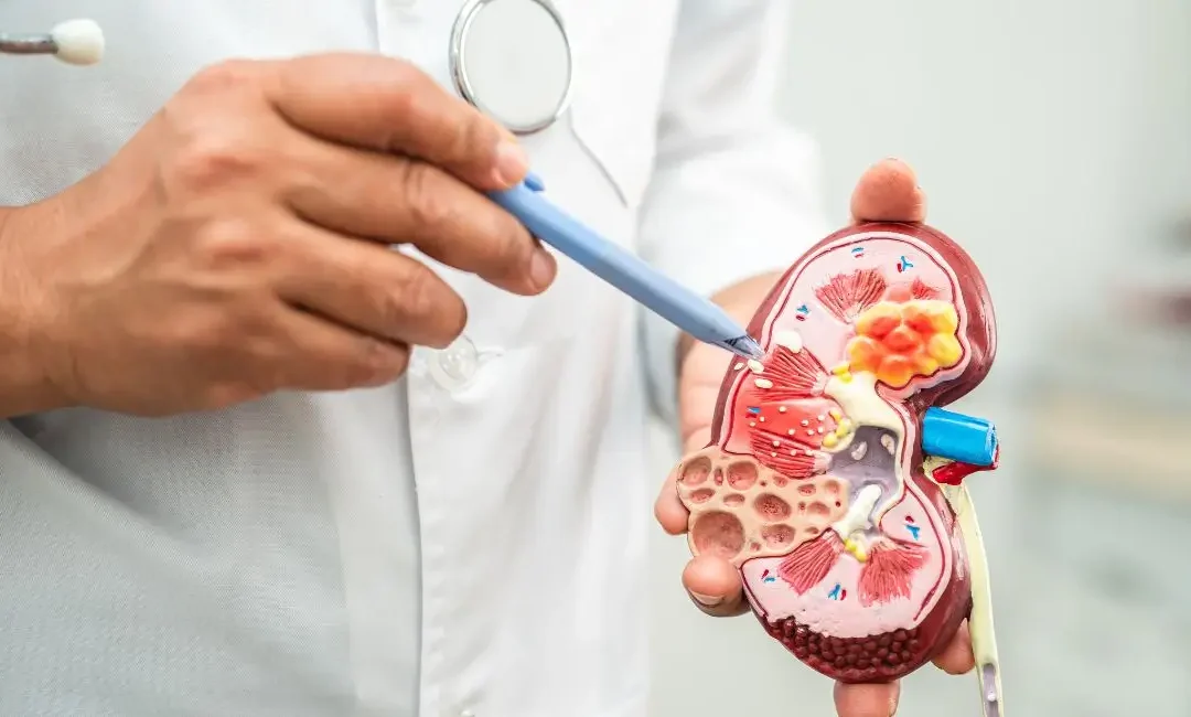 Does A Kidney Infection Cause Bloating? Knowing The Causes And Symptoms