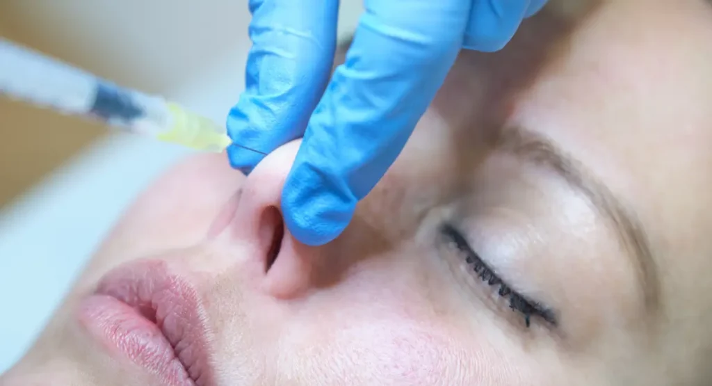 How to Make Your Nose Smaller Dermal Fillers For Reshaping